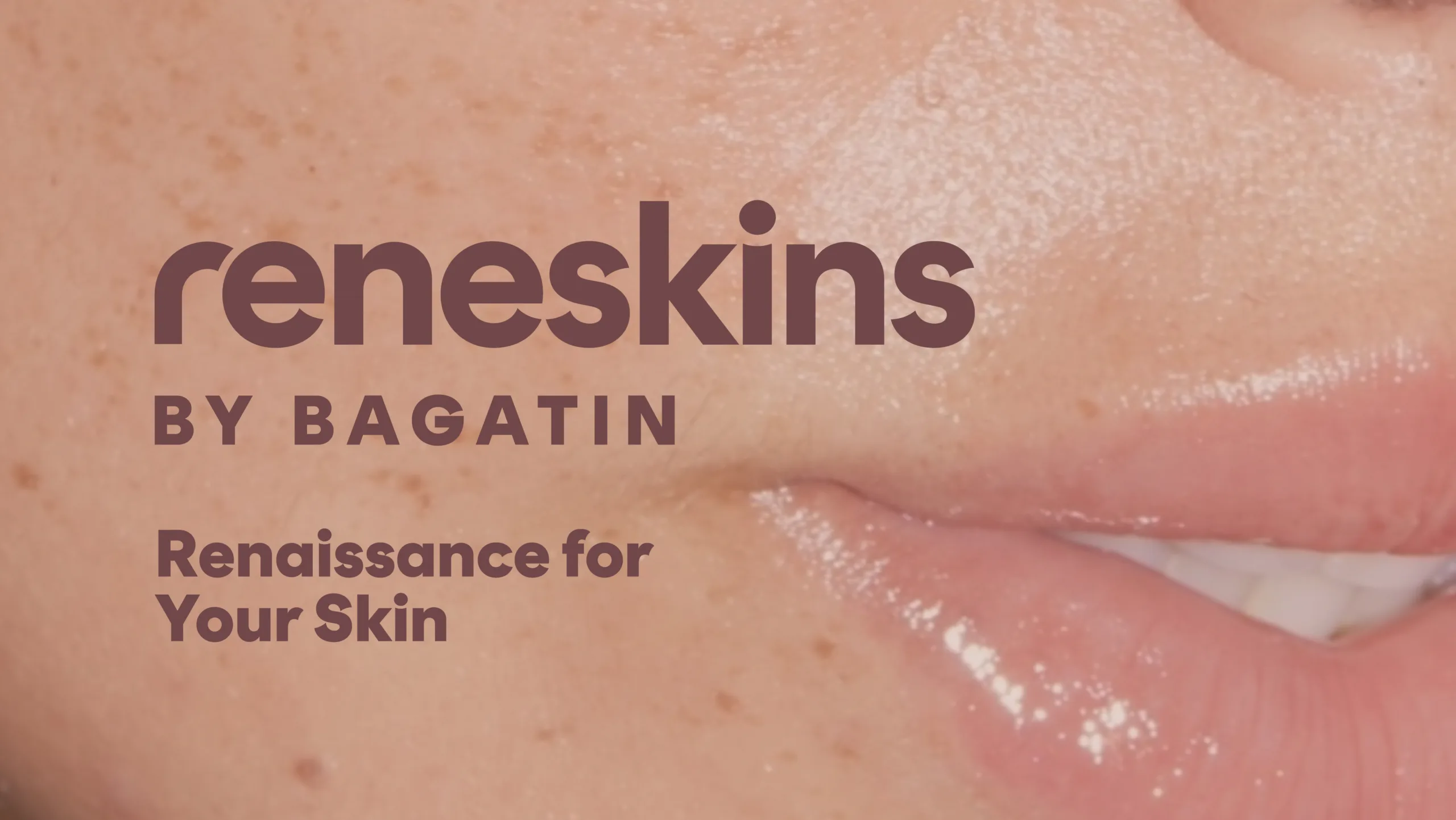 Reneskins web case 1180x664 1