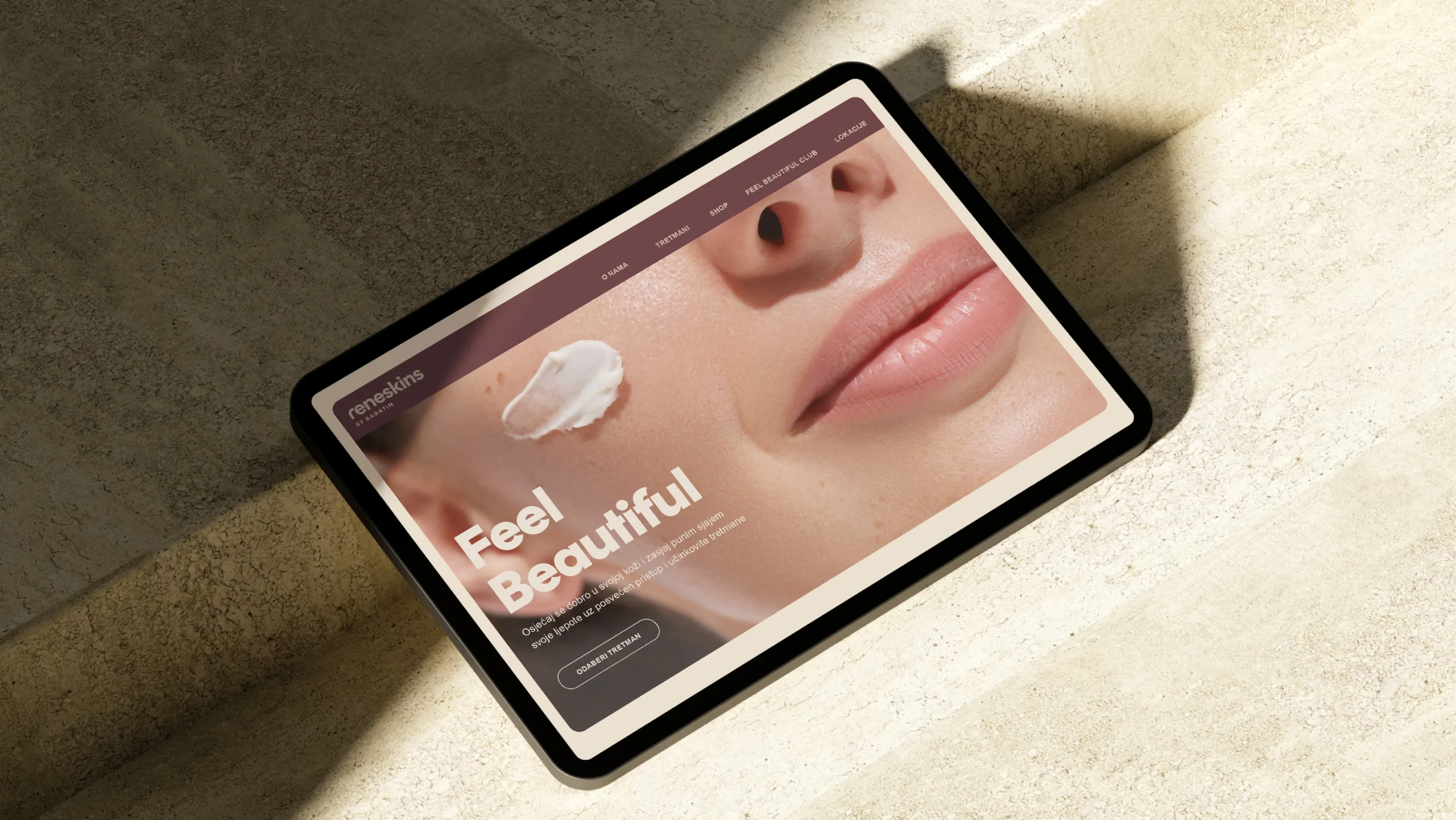 Reneskins web case 1180x664 5
